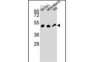 ZFP30 Antibody (N-term) (ABIN657359 and ABIN2846409) western blot analysis in ZR-75-1,MDA-M,293 cell line lysates (35 μg/lane). (ZFP30 Antikörper  (N-Term))