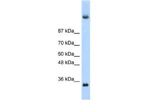 WB Suggested Anti-DAZ4 Antibody Titration:  0. (DAZ4 Antikörper  (N-Term))