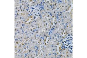 Immunohistochemistry of paraffin-embedded rat kidney using SPHK1 Antibody (ABIN5970017) at dilution of 1/200 (40x lens). (SPHK1 Antikörper)