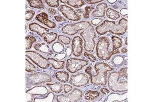 Immunohistochemical staining of human kidney with COX14 polyclonal antibody  shows strong cytoplasmic positivity in cells in tubules. (COX14 Antikörper)