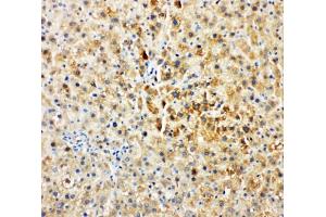 IHC-P: Tec antibody testing of rat liver tissue (NR4A3 Antikörper  (AA 612-631))