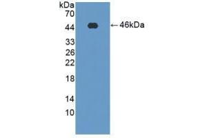 Detection of Recombinant PFKM, Rat using Polyclonal Antibody to Phosphofructokinase, Muscle (PFKM) (PFKM Antikörper  (AA 2-390))
