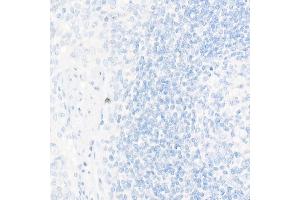 Immunohistochemistry (IHC) image for anti-NK2 Homeobox 1 (NKX2-1) antibody (ABIN1679475)
