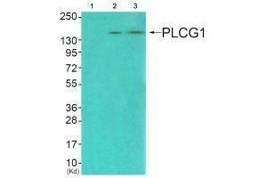Western blot analysis of extracts from COS7 cells (Lane 2), and JK cells (Lane 3), using PLCG1 (Ab-771) antiobdy. (Phospholipase C gamma 1 Antikörper  (Tyr771))