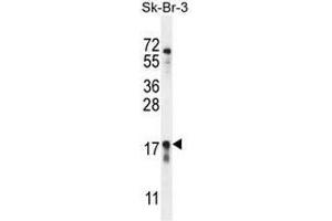 CA115 Antibody (Center) western blot analysis in SK-BR-3 cell line lysates (35µg/lane). (C1ORF115 Antikörper  (Middle Region))