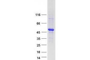 Validation with Western Blot (TADA3L Protein (Transcript Variant 2) (Myc-DYKDDDDK Tag))