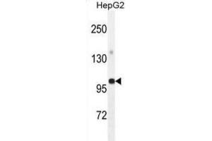 Western Blotting (WB) image for anti-Glycerol-3-Phosphate Acyltransferase, Mitochondrial (GPAM) antibody (ABIN2995540) (GPAM Antikörper)