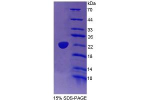 SDS-PAGE analysis of Human TRERF1 Protein. (TRERF1 Protein)