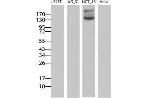 Image no. 2 for anti-ATP-Binding Cassette, Sub-Family B (MDR/TAP), Member 1 (ABCB1) (AA 347-710) antibody (ABIN1491437) (ABCB1 Antikörper  (AA 347-710))