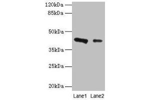 Western blot All lanes: RAD23B antibody at 2 μg/mL Lane 1: 293T whole cell lysate Lane 2: MCF-7 whole cell lysate Secondary Goat polyclonal to rabbit IgG at 1/10000 dilution Predicted band size: 44, 36 kDa Observed band size: 44 kDa (RAD23B Antikörper  (AA 1-250))