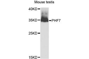 Western blot analysis of extracts of Mouse testis cells, using PHF7 antibody. (PHF7 Antikörper)