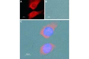 Expression of SERCA1 in mouse C2C12 myoblast cell line - Immunocytochemical staining of fixed and permeabilized C2C12 cells. (ATP2A1/SERCA1 Antikörper  (Cytosolic))