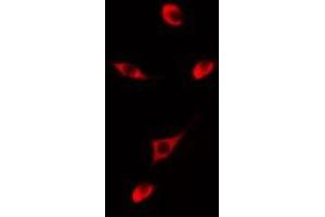 anti-Cytochrome P450, Family 2, Subfamily D, Polypeptide 6 (CYP2D6) antibody