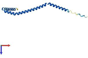 MEF2BNB Protein (AA 1-119) (His tag)