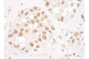 Immunohistochemistry (IHC) image for anti-X-Ray Repair Complementing Defective Repair in Chinese Hamster Cells 5 (Double-Strand-Break Rejoining) (XRCC5) (AA 150-200) antibody (ABIN7453719)