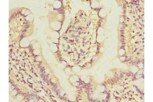 Immunohistochemistry of paraffin-embedded human small intestine tissue using ABIN7153881 at dilution of 1:100 (GLP2R Antikörper  (AA 1-180))