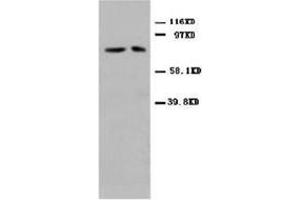 Western blot analysis of rat cardiac muscle tissue lysis using MFN antibody (MFN2 Antikörper  (N-Term))