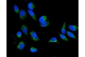 IF analysis of GRPEL1 using anti-GRPEL1 antibody (ABIN7602643).