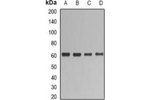 Western blot analysis of UGT1A1 expression in HepG2 (A), SHSY5Y (B), mouse liver (C), rat liver (D) whole cell lysates. (UGT1A1 Antikörper)