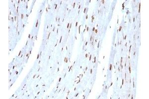 Formalin-fixed, paraffin-embedded rat heart stained with SUMO-2 antibody. (SUMO2 Antikörper)