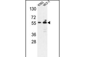 Western blot analysis of G6PD Antibody (Center) (ABIN651286 and ABIN2840171) in K562,MCF-7 cell line lysates (35 μg/lane). (Glucose-6-Phosphate Dehydrogenase Antikörper  (AA 297-326))