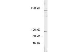 dilution: 1 : 1000, sample: rat hippocampus homogenate (SHANK3 Antikörper  (AA 1055-1616))