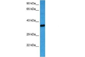 Host:  Mouse  Target Name:  AKR1B1  Sample Tissue:  Mouse Heart  Antibody Dilution:  1ug/ml (AKR1B1 Antikörper  (C-Term))