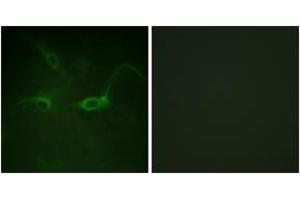 Immunofluorescence analysis of COS7 cells, using FGFR1 (Phospho-Tyr654) Antibody. (FGFR1 Antikörper  (pTyr654))