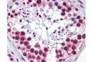 Anti-RSL24D1 / C15orf15 antibody IHC of human testis. (RSL24D1 Antikörper  (AA 1-151))