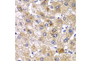 Immunohistochemistry of paraffin-embedded human liver injury using AMY2A antibody at dilution of 1:100 (x40 lens).