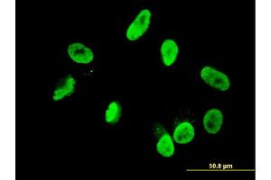 Immunofluorescence of monoclonal antibody to RNF168 on HepG2 cell. (RNF168 Antikörper  (AA 462-571))