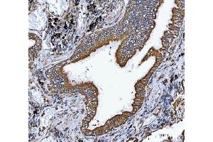 IHC analysis of VAPA using anti-VAPA antibody (ABIN7603249). (VAPA Antikörper  (N-Term))