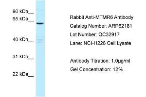 Western Blotting (WB) image for anti-Myotubularin Related Protein 6 (MTMR6) (C-Term) antibody (ABIN2789053)