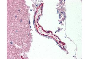 Immunohistochemistry (IHC) image for anti-ATP-Binding Cassette, Sub-Family B (MDR/TAP), Member 1 (ABCB1) (AA 995-1280) antibody (ABIN1804644)