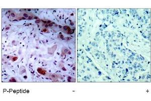 Image no. 1 for anti-Janus Kinase 1 (JAK1) (pTyr1022) antibody (ABIN196869) (JAK1 Antikörper  (pTyr1022))