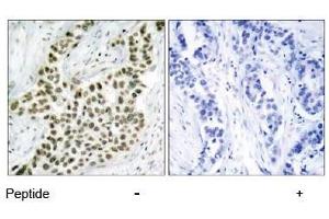 Image no. 3 for anti-H2A Histone Family, Member X (H2AFX) (Ser139) antibody (ABIN197524) (H2AFX Antikörper  (Ser139))
