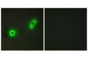 Immunofluorescence analysis of A549 cells, using Ik3-2 antibody. (CABLES2 Antikörper)