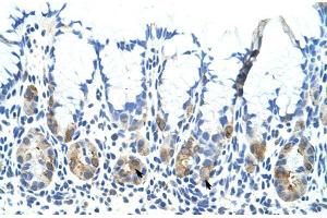 Human Stomach; Rabbit Anti-ADAT1 Antibody. (ADAT1 Antikörper  (C-Term))