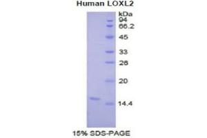 SDS-PAGE (SDS) image for Lysyl Oxidase-Like 2 (LOXL2) (AA 323-427) protein (His tag) (ABIN1877614)