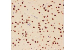Anti-ATF2 Picoband antibody,  IHC(P): Rat Brain Tissue (ATF2 Antikörper  (AA 93-450))