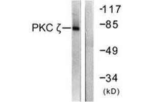 Western blot analysis of extracts from COS7 cells, treated with PMA 125ng/ml 30', using PKC zeta (Ab-560) Antibody. (PKC zeta Antikörper  (AA 526-575))