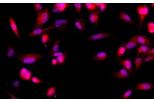 Immunofluorescence analysis of U-251MG cells using BRCA2 Polyclonal Antibody at dilution of 1:100