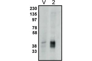 Image no. 1 for anti-Phosphatidic Acid Phosphatase Type 2C (PPAP2C) antibody (ABIN398285)