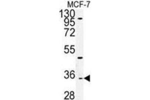 Western Blotting (WB) image for anti-Tocopherol (Alpha) Transfer Protein-Like (TTPAL) antibody (ABIN3002253)