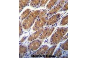 CLDN2 Antibody (C-term pTyr195) immunohistochemistry analysis in formalin fixed and paraffin embedded human stomach tissue followed by peroxidase conjugation of the secondary antibody and DAB staining. (Claudin 2 Antikörper  (C-Term))