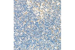 Immunohistochemistry of paraffin embedded rat thymus using Skar (ABIN7074970) at dilution of 1:1800 (400x lens) (p46 Antikörper)