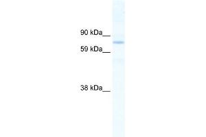 WB Suggested Anti-SIN3B Antibody Titration:  2. (SIN3B Antikörper  (N-Term))