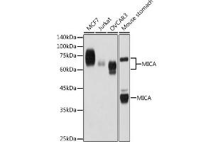 Western blot analysis of extracts of various cell lines, using MICA antibody (ABIN7268508) at 1:1000 dilution. (MICA Antikörper)