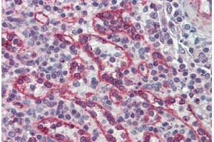 Human Spleen: Formalin-Fixed, Paraffin-Embedded (FFPE) (IRAK2 Antikörper  (AA 111-210))