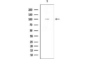 Western blot analysis of lysates from Rat lung, using alpha 1 Catenin Mouse Monoclonal Antibody at 1/1000 dilution.